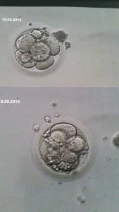 Here's hoping that one of these embryos is my future child!